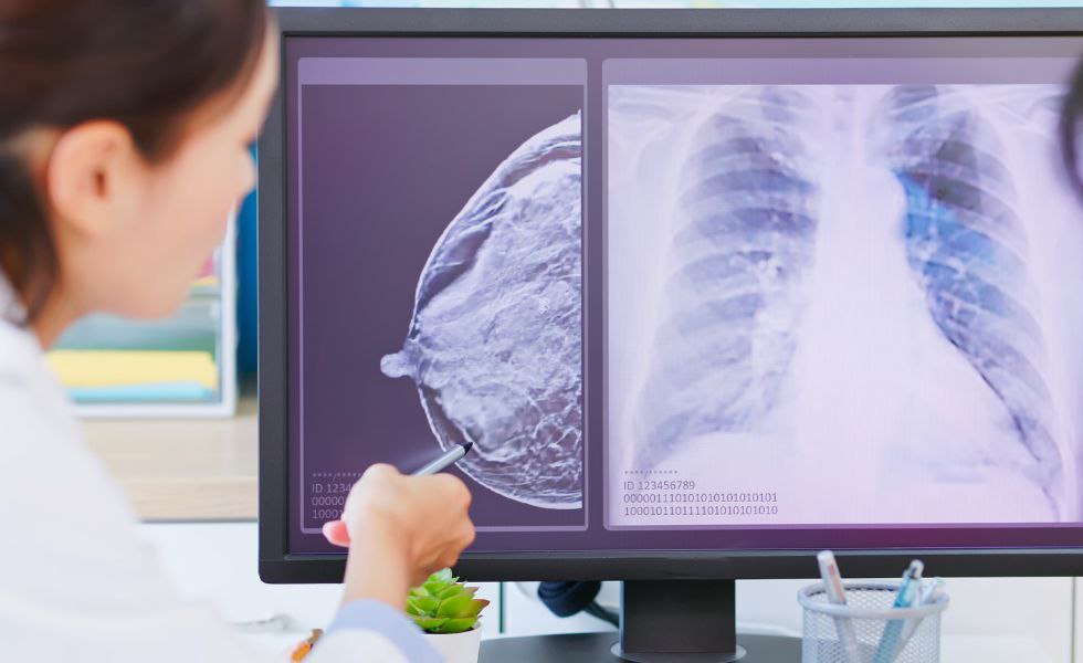 Breast Cancer Diagnosis