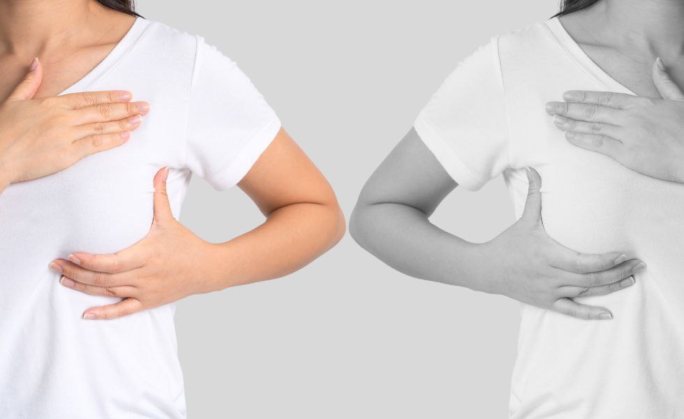 Breast Cancer Starting Places